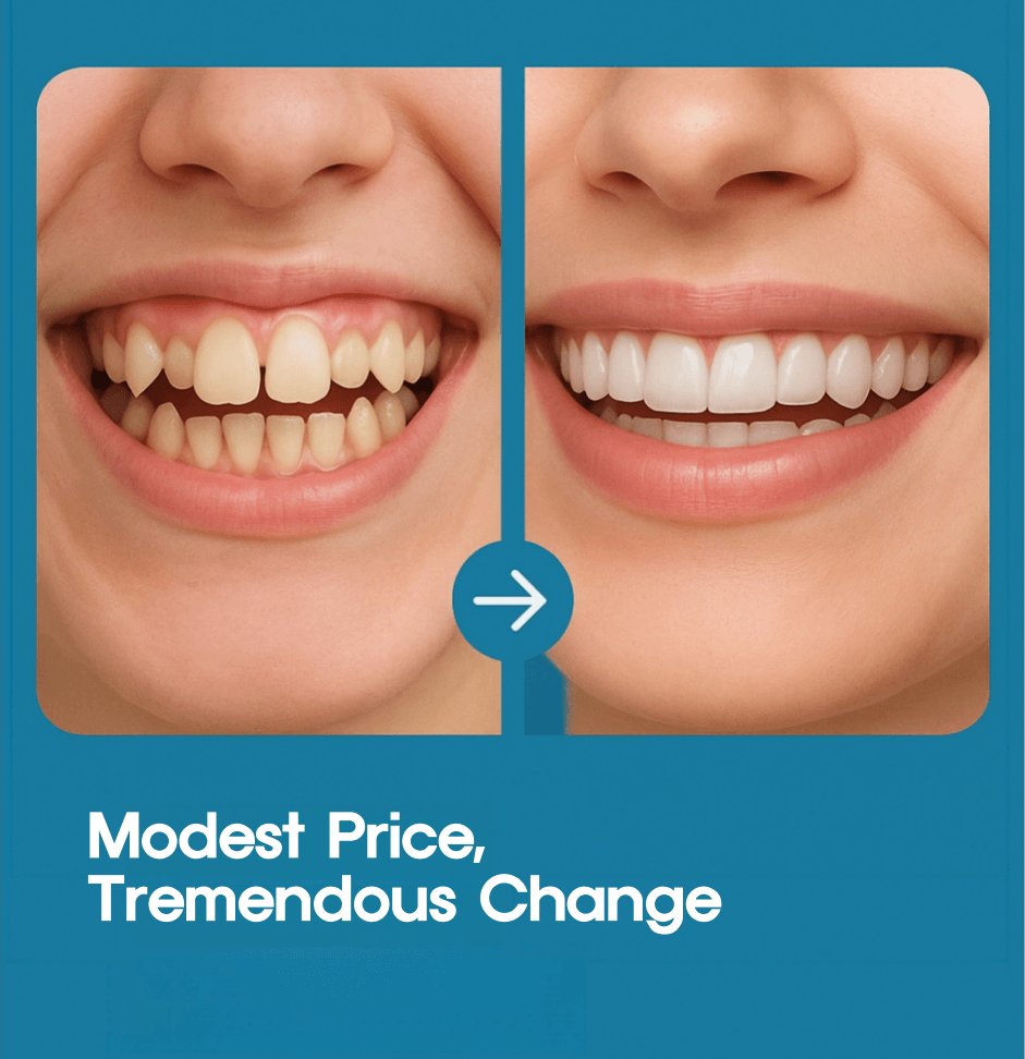 Before and after results of teeth straightening with an Aligner for a perfect smile.