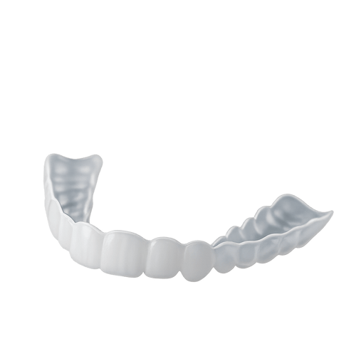 Decorative Veneer for instant cosmetic fixes, masks dental imperfections and restores smiles effortlessly.