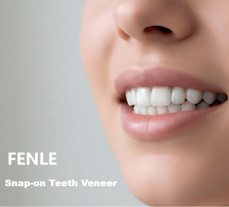 Smiling woman showcasing Decorative Veneer for a flawless, confident smile with snap-on teeth veneer.